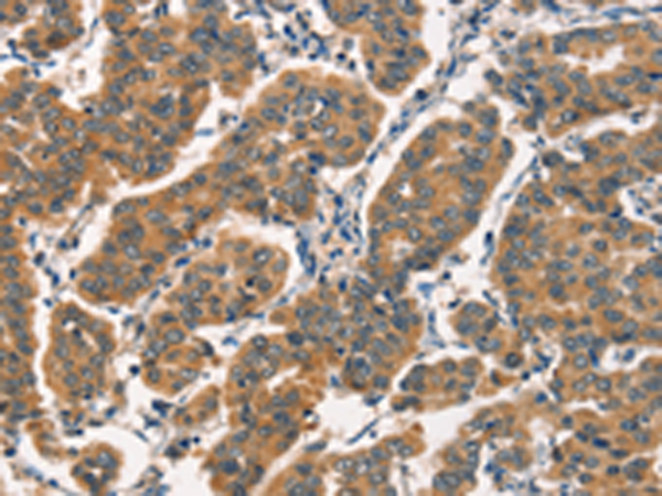 Anti-ARL6IP1 Rabbit Polyclonal Antibody