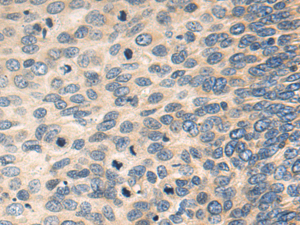 Anti-GNMT Rabbit Polyclonal Antibody