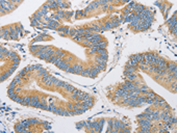 Anti-FARSB Rabbit Polyclonal Antibody