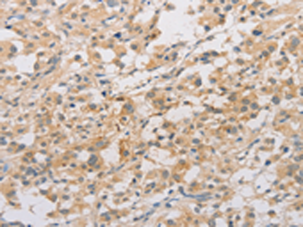 Anti-ARSF Rabbit Polyclonal Antibody