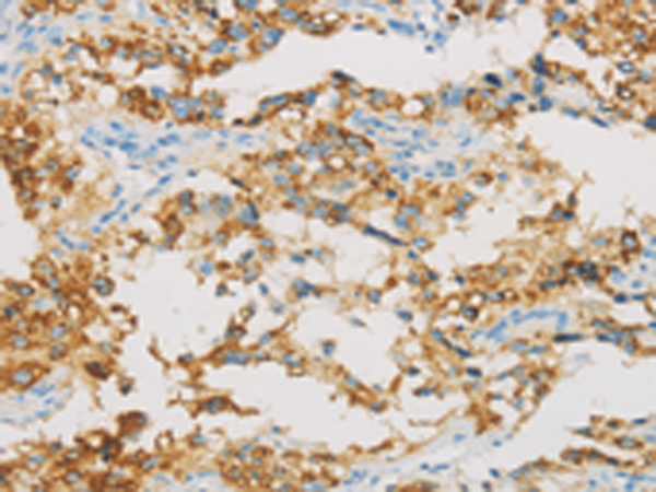 Anti-IDH3B Rabbit Polyclonal Antibody