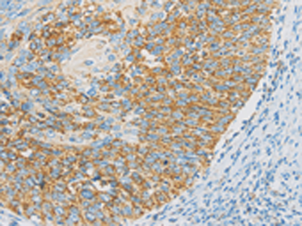 Anti-IDH3G Rabbit Polyclonal Antibody
