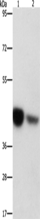 Anti-IDH3G Rabbit Polyclonal Antibody