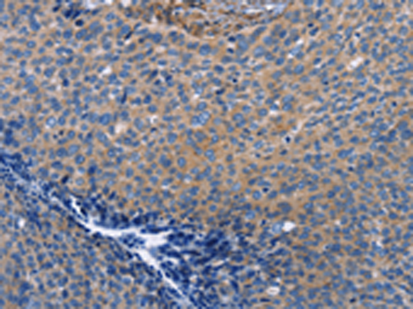 Anti-INTS10 Rabbit Polyclonal Antibody