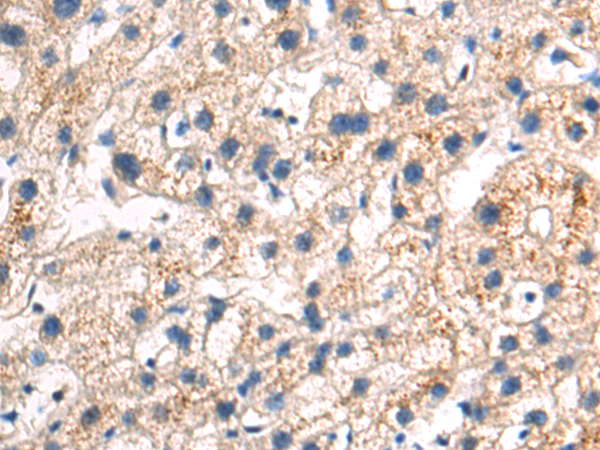 Anti-K Cadherin Rabbit Polyclonal Antibody