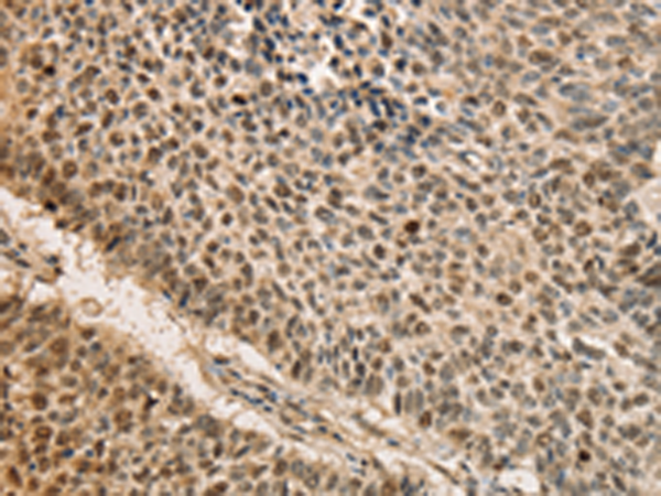 Anti-Borealin Rabbit Polyclonal Antibody