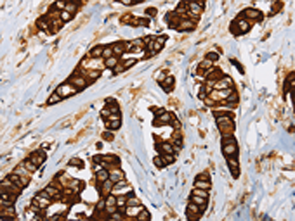 Anti-Toll-Like Receptor 6 Rabbit Polyclonal Antibody