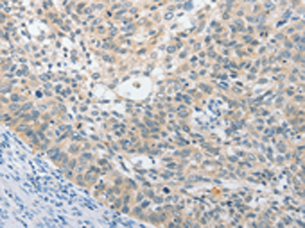 Anti-UCHL5 Rabbit Polyclonal Antibody