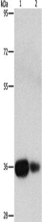 Anti-UCHL5 Rabbit Polyclonal Antibody