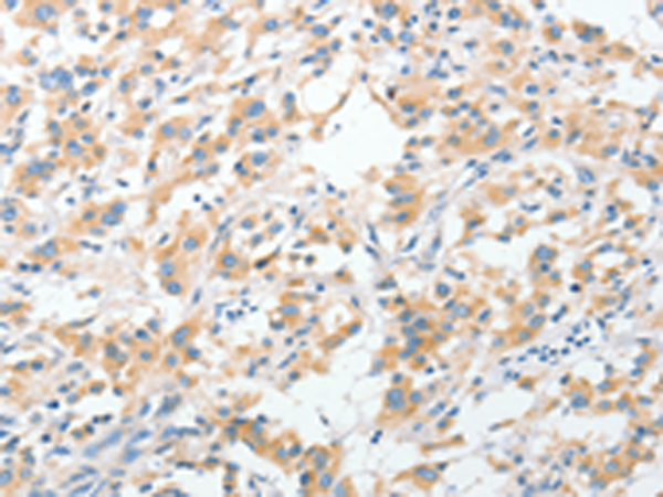 Anti-Ribophorin I Rabbit Polyclonal Antibody