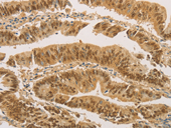 Anti-PSMB7 Rabbit Polyclonal Antibody