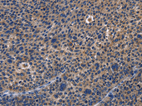 Anti-PKC delta Rabbit Polyclonal Antibody