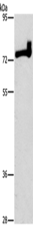 Anti-PKC delta Rabbit Polyclonal Antibody