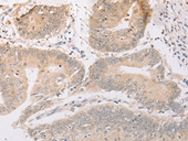 Anti-MARK1 Rabbit Polyclonal Antibody