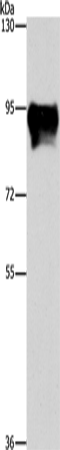 Anti-MARK1 Rabbit Polyclonal Antibody