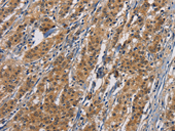 Anti-PIKFYVE Rabbit Polyclonal Antibody