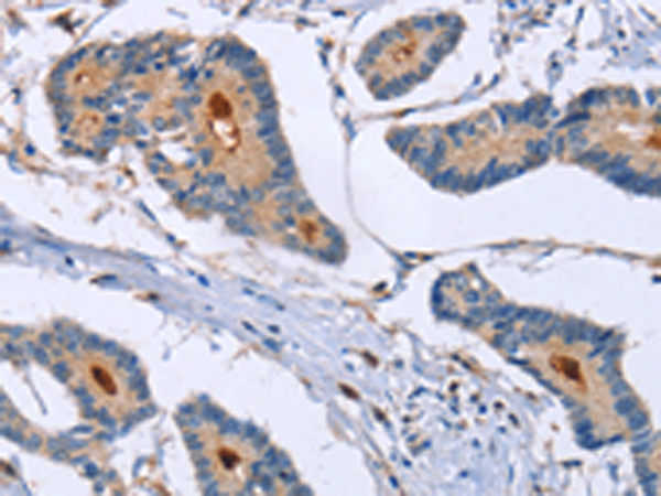 Anti-GMFG Rabbit Polyclonal Antibody