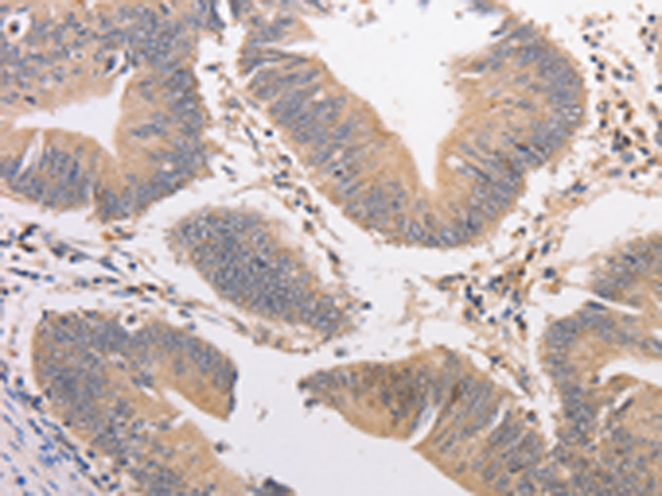 Anti-PIP5K1A Rabbit Polyclonal Antibody