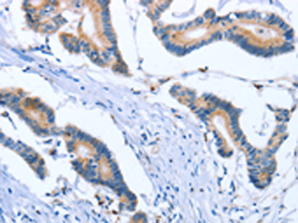 Anti-PLK3 Rabbit Polyclonal Antibody