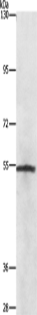 Anti-NEK2 Rabbit Polyclonal Antibody