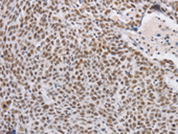 Anti-THOC7 Rabbit Polyclonal Antibody