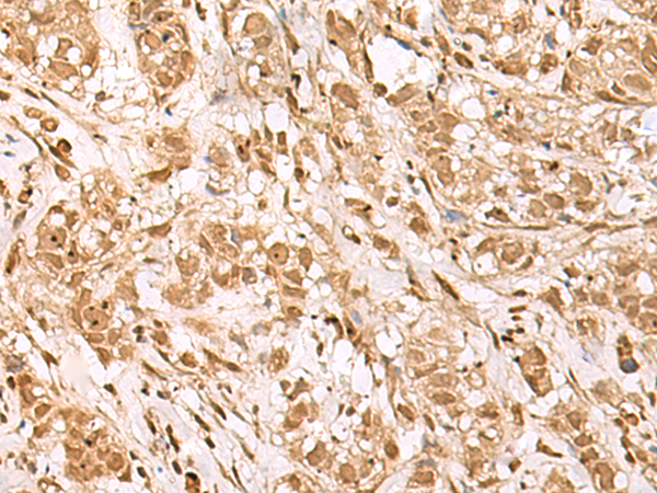 Anti-BAP1 Rabbit Polyclonal Antibody