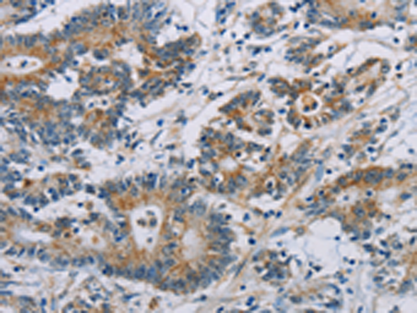 Anti-CSNK1E Rabbit Polyclonal Antibody