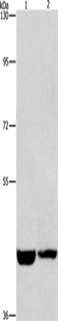 Anti-CSNK1E Rabbit Polyclonal Antibody