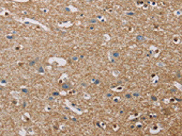 Anti-PIP4K2A Rabbit Polyclonal Antibody