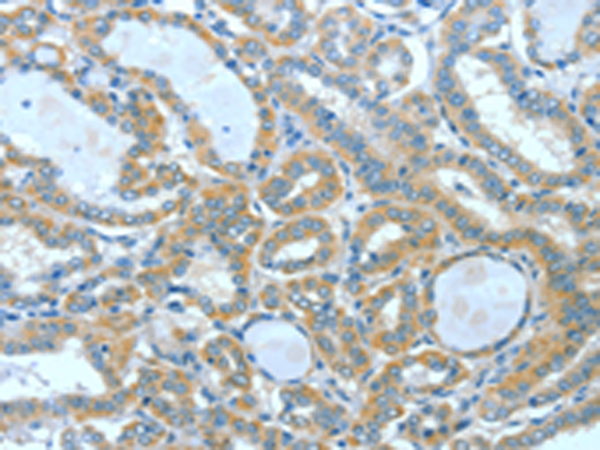 Anti-SPHK2 Rabbit Polyclonal Antibody
