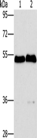 Anti-SPHK2 Rabbit Polyclonal Antibody