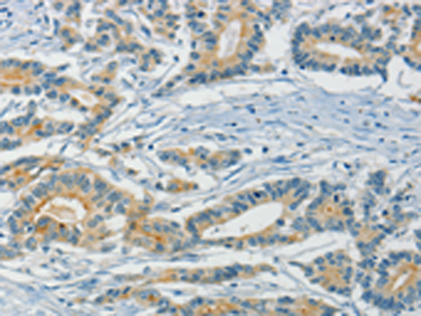 Anti-ASAH2 Rabbit Polyclonal Antibody