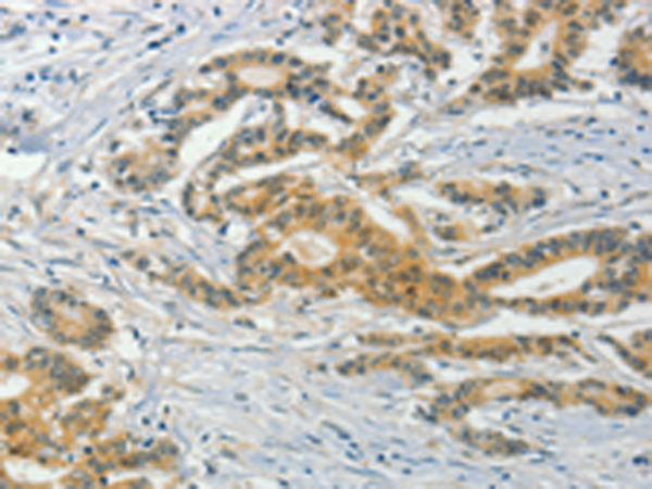 Anti-ASB8 Rabbit Polyclonal Antibody