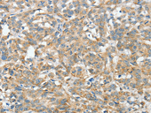 Anti-ASCC1 Rabbit Polyclonal Antibody