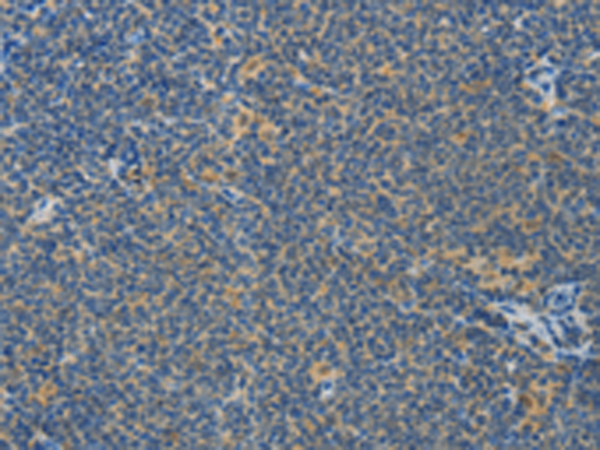 Anti-ASPA Rabbit Polyclonal Antibody