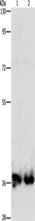 Anti-ASPA Rabbit Polyclonal Antibody