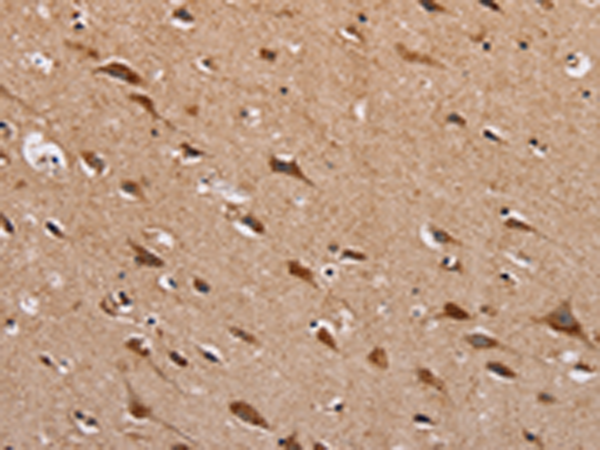 Anti-HTR3C Rabbit Polyclonal Antibody