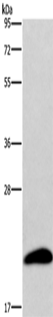 Anti-AKIP Rabbit Polyclonal Antibody