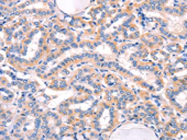 Anti-AMY2A Rabbit Polyclonal Antibody