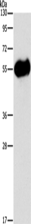 Anti-AMY2A Rabbit Polyclonal Antibody