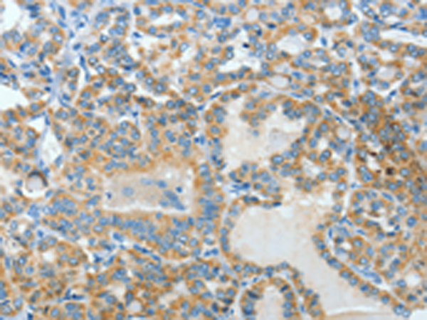 Anti-BAAT Rabbit Polyclonal Antibody