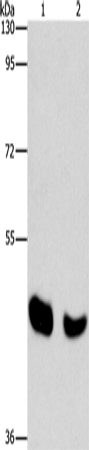 Anti-BAAT Rabbit Polyclonal Antibody