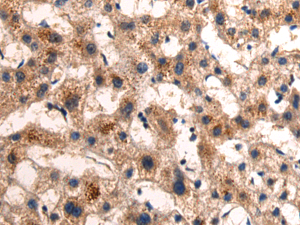 Anti-BCAT1 Rabbit Polyclonal Antibody