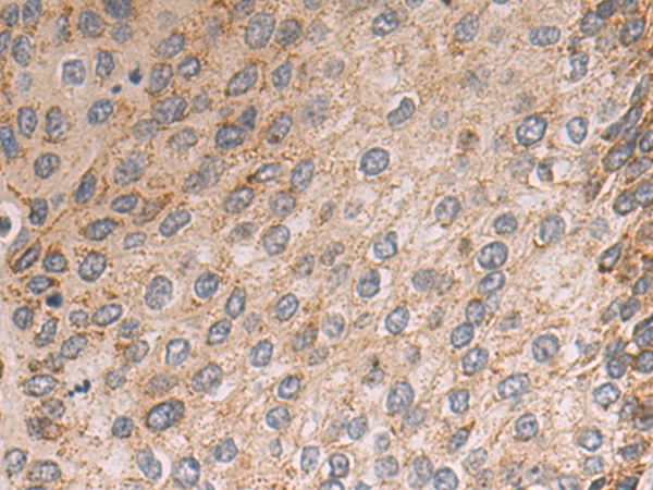 Anti-BCAT2 Rabbit Polyclonal Antibody