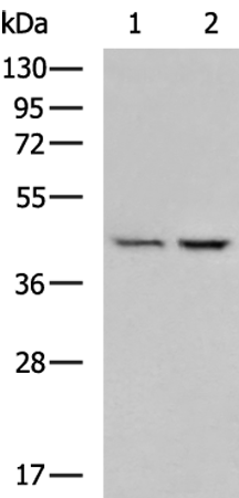 Anti-BCAT2 Rabbit Polyclonal Antibody