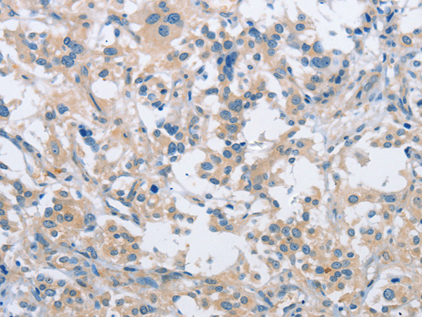 Anti-Bif Rabbit Polyclonal Antibody