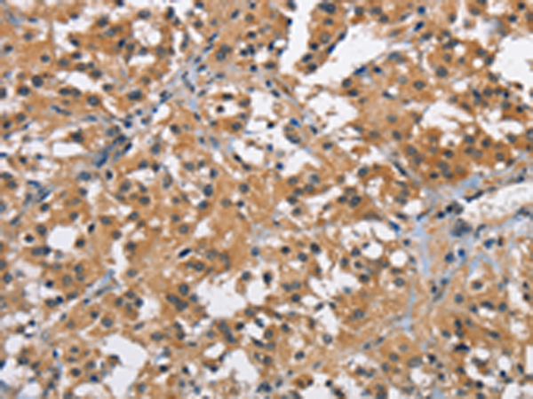 Anti-BRCC45 Rabbit Polyclonal Antibody