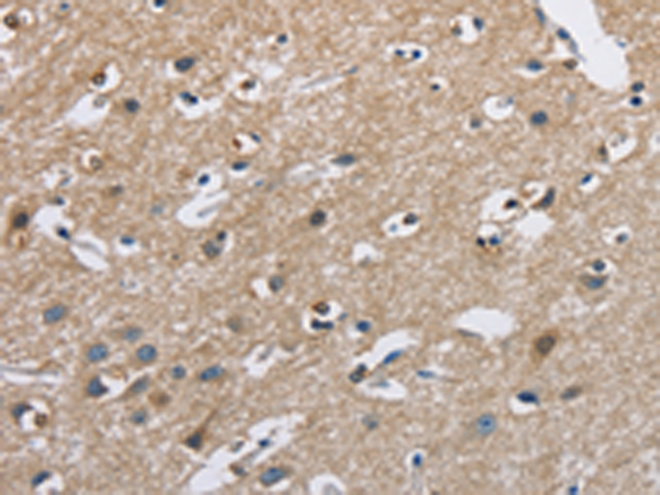 Anti-CAB39L Rabbit Polyclonal Antibody