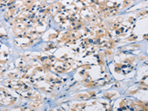 Anti-CARD14 Rabbit Polyclonal Antibody