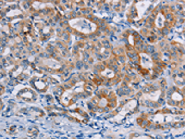 Anti-CASC3 Rabbit Polyclonal Antibody